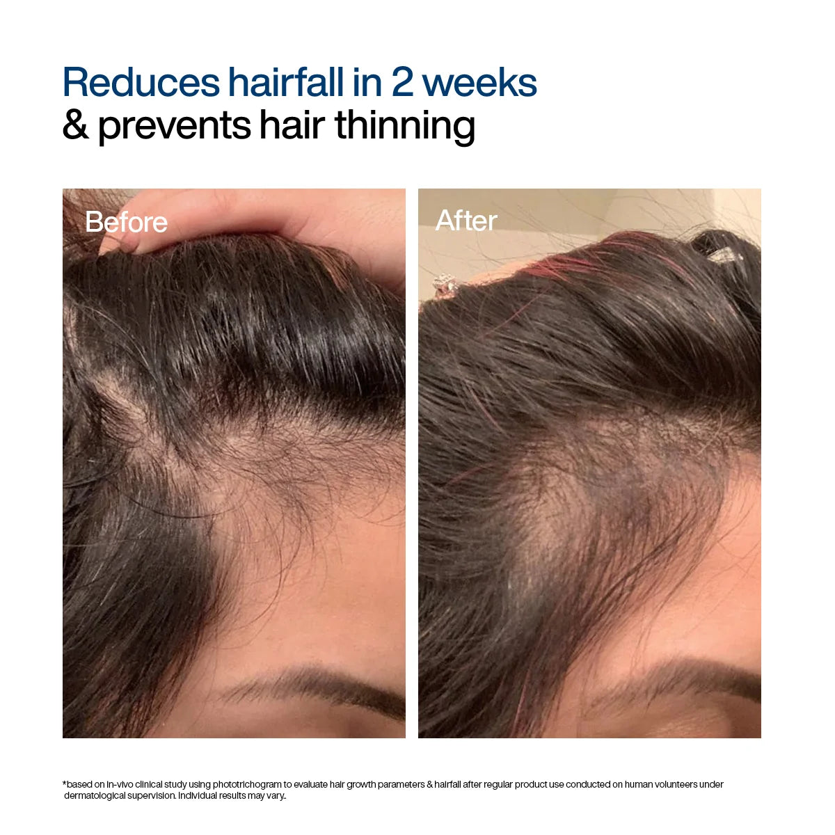 Hair Growth Serum Concentrate Roll-On