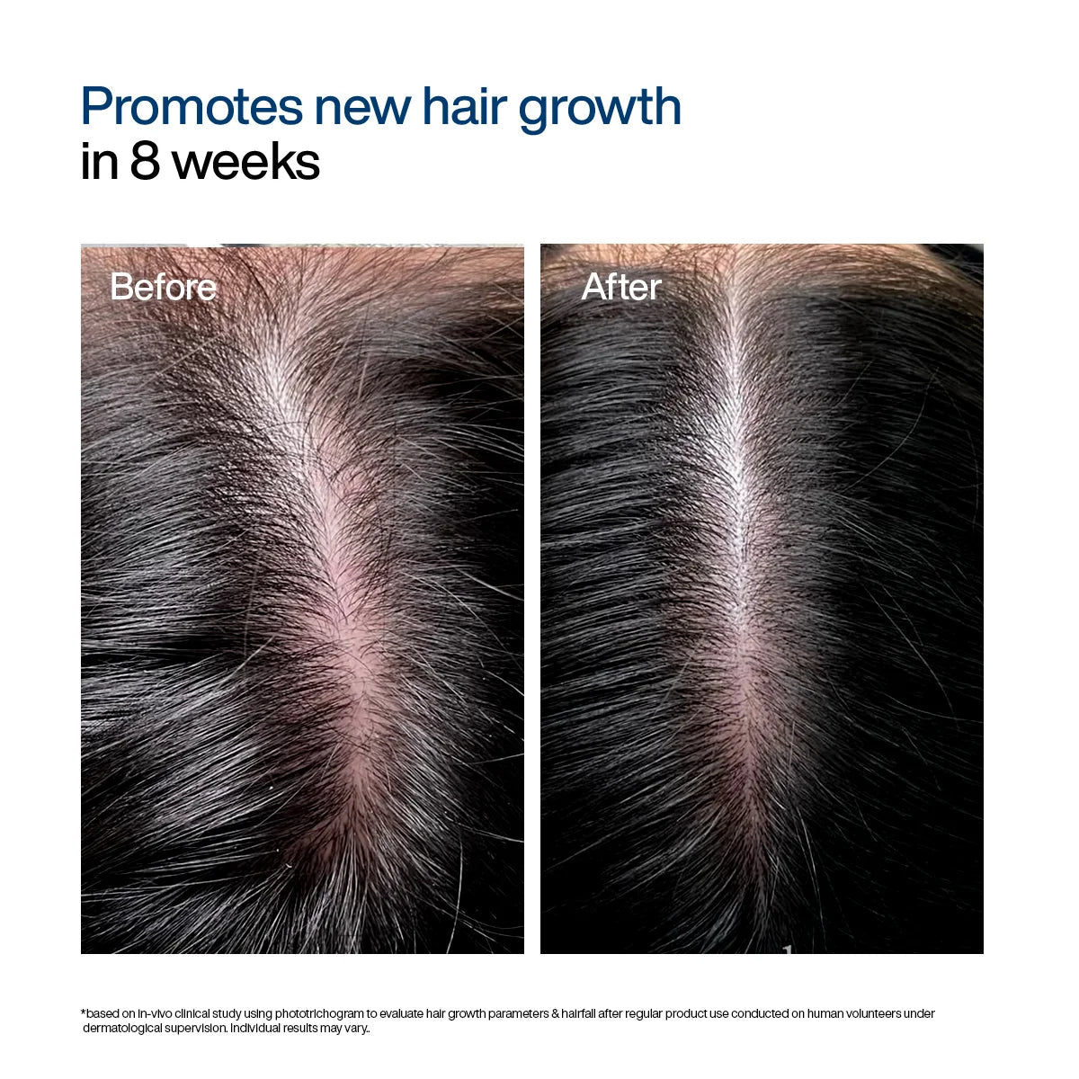 Hair Growth Serum Concentrate Roll-On