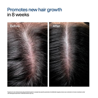 Hair Growth Serum Concentrate Roll-On